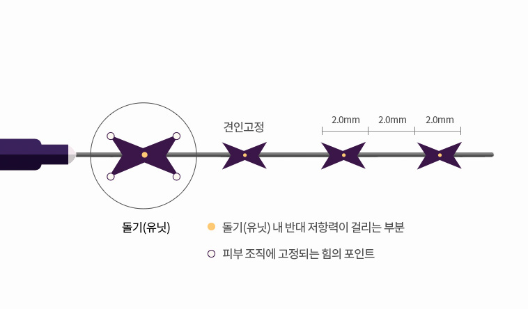 허쉬성형외과 맥스리프팅